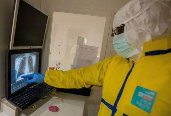 Κορωνοϊός: VIDEO - σοκ καταγράφει πόση βλάβη προκαλεί στους πνεύμονες ο ιός