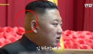 Βόρεια Κορέα: Νέα σενάρια για την υγεία του Κιμ Γιονγκ Ουν
