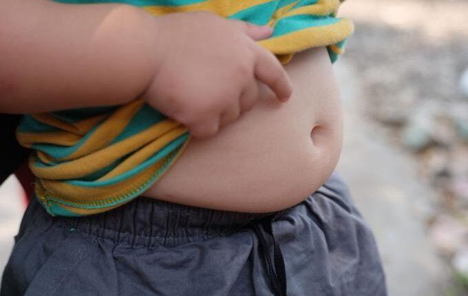 Πάνω από τους μισούς Έλληνες υπέρβαροι ή παχύσαρκοι - Πρώτη στην παιδική παχυσαρκία η Ελλάδα