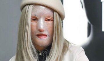 Η Ιωάννα Παλιοσπύρου δείχνει για πρώτη φορά το πρόσωπό της μετά την επίθεση με το βιτριόλι (ΦΩΤΟ)