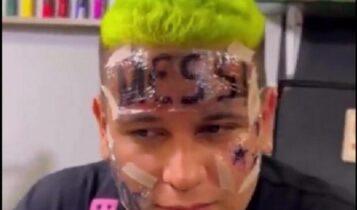Η τρέλα της στιγμής: Οπαδός της Αργεντινής έκανε τατουάζ Μέσι στο πρόσωπό του και τώρα δηλώνει μετανιωμένος (ΦΩΤΟ)