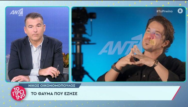 Νίκος Οικονομόπουλος: Το... θαύμα που βίωσε μπροστά στην κάμερα (VIDEO)