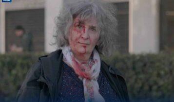 Η μυστηριώδης γυναίκα με αίματα χθες στο Σύνταγμα – Γιατί η Αστυνομία εξέδωσε ανακοίνωση (ΦΩΤΟ)