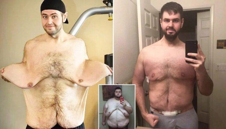 Έχασε 140 κιλά, μεταμορφώθηκε και παντρεύτηκε τη γυναίκα της ζωής του (ΦΩΤΟ)