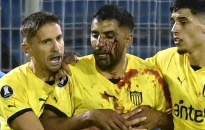 Χαμός σε ματς του Κόπα Λιμπερταδόρες: Παίκτης της Πενιαρόλ δέχτηκε πέτρα στο πρόσωπο από την εξέδρα! (VIDEO)